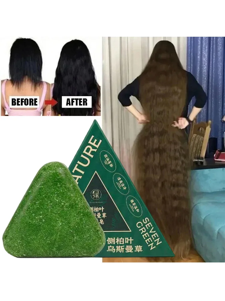Usman Grass & Platycladus Shampoo Bar per la crescita dei capelli Sapone a base di erbe naturali per la perdita dei capelli Controlla l'olio Rafforza le radici Shampoo - immagine 5