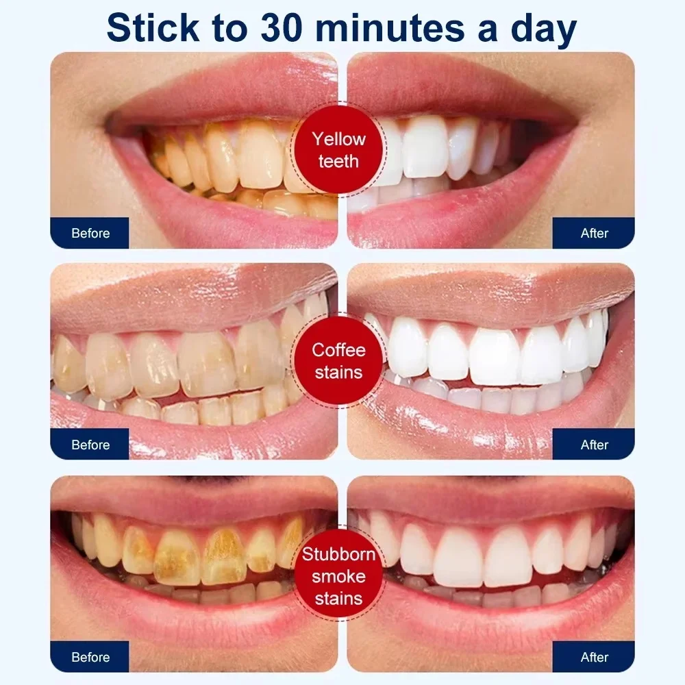 5 Days Teeth Whitening Powder Remove Plaque Stains Dental Calculus Oral Hygiene Tooth Care