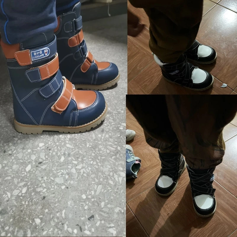 Inverno crianças botas de alta qualidade sapatos ortopédicos para