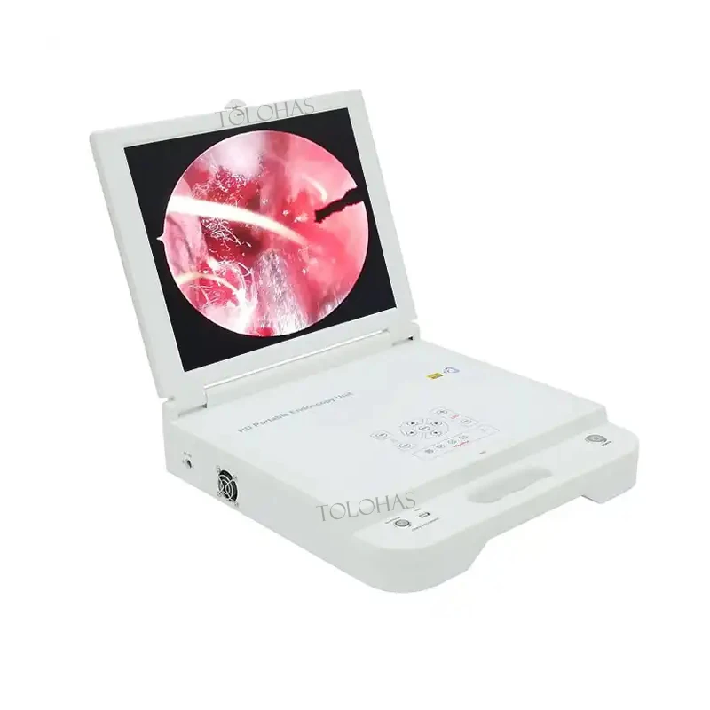 

LHGW612 Portable HD Medical Led Light Source ENT CCDPortable Endoscopy Unit