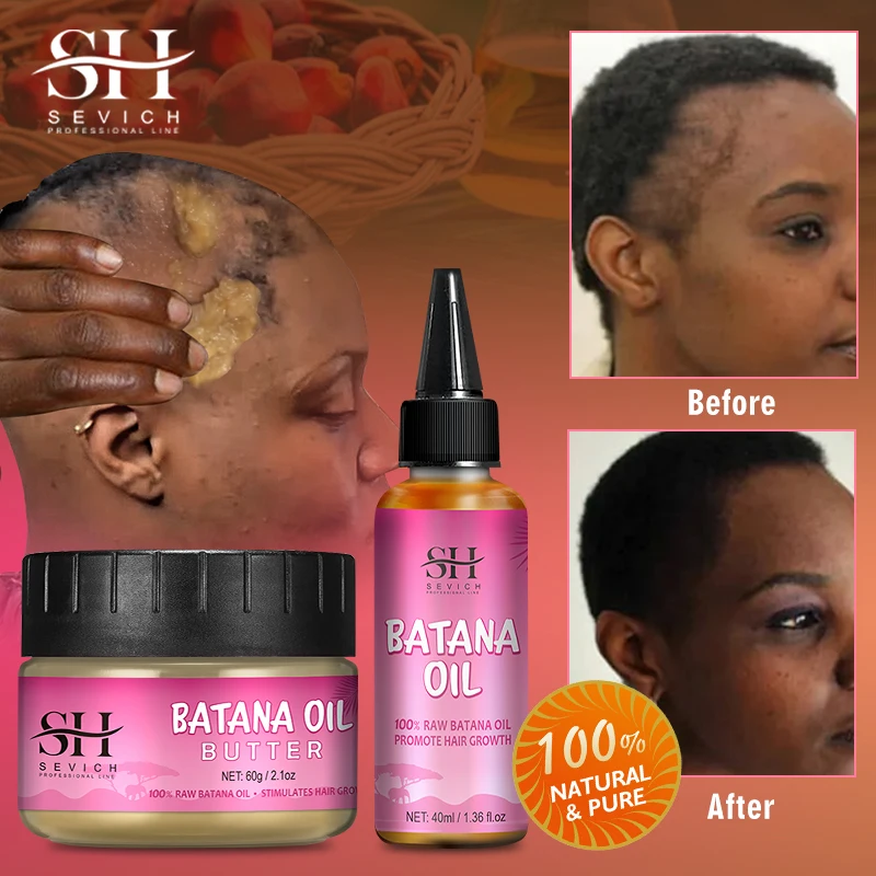 100% Batana Hair Fast Growth Oil Set African Crazy Traction Alopecia Batana Hair Mask Anti Hair Break Hair Regrowth Treatment