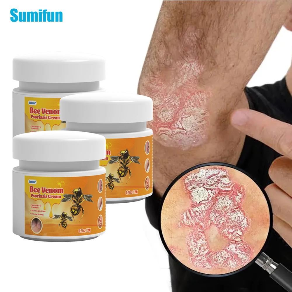 Skin Care Ointment Antibacterial Anti Fungal Cream 1/2/3Pcs Sumifun Bee Venom Psoriasis Cream Dermatitis Pruritus Eczema Ointment Skin Anti Itching Antibacterial Medical Plaster