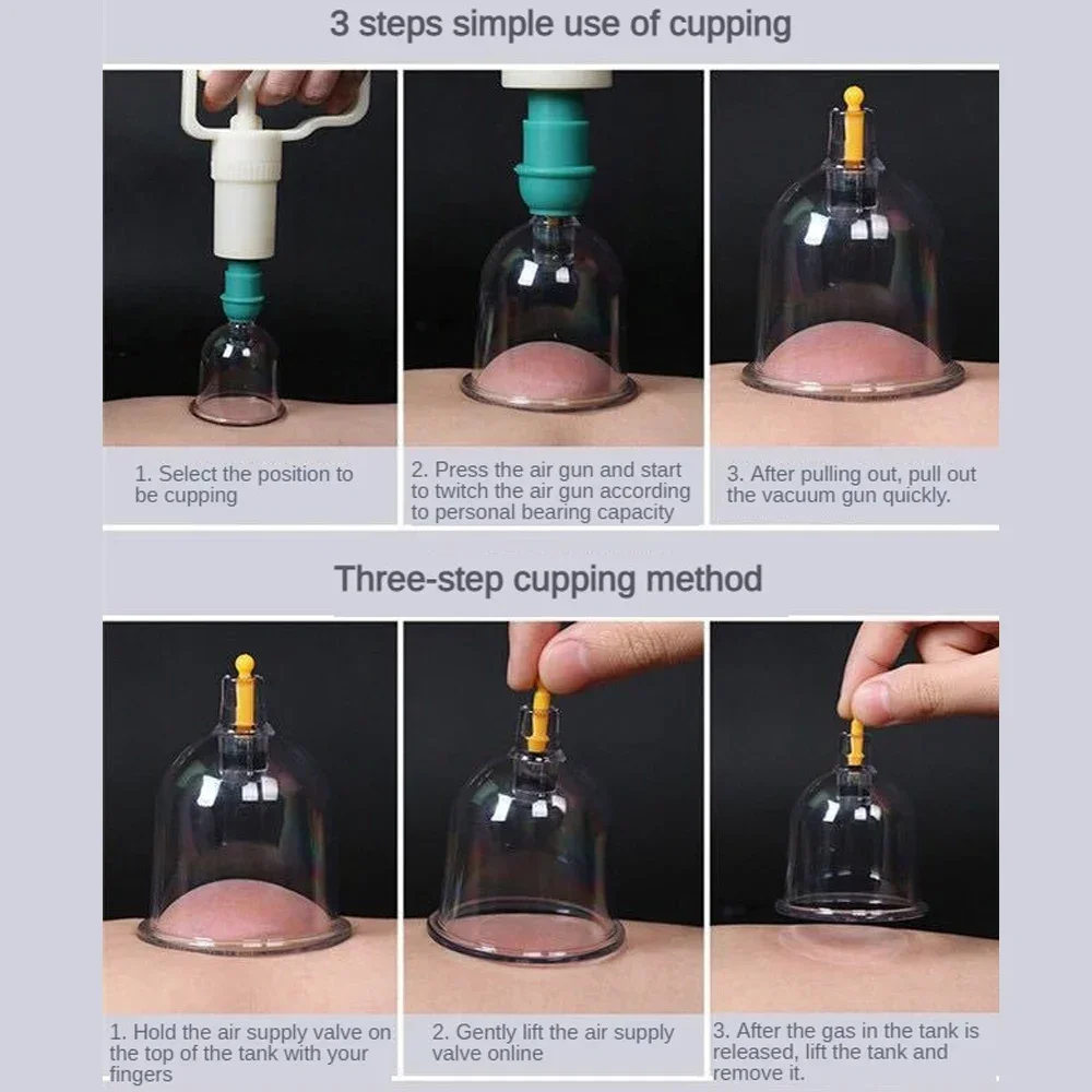 1pc Vacuum Cupping Massage Jar Cans Chinese Medicine Physiotherapy Anti-Cellulite Suction Cups Body Massager Healthy Care 4