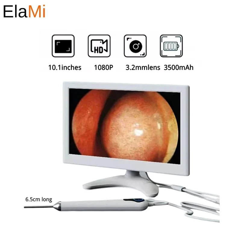 

Digital Otoscope 10.1 Inch Screen 3.2mm 1080P HD Ear Scope ENT Endoscope Ear Cleaner With 5000mAh Rechargeable Battery