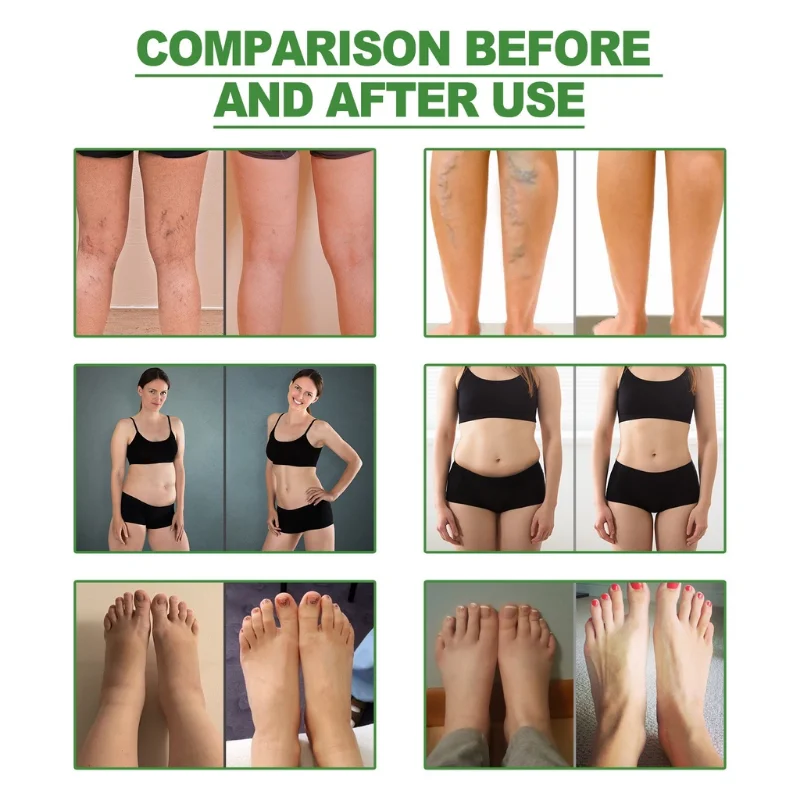 10-100pcs Korea Kinoki Detox Foot Patches for Stress Relief Deep Sleep Herbal Slimming Body Fat Toxins Deep Cleansing Foot Pads foot care patches