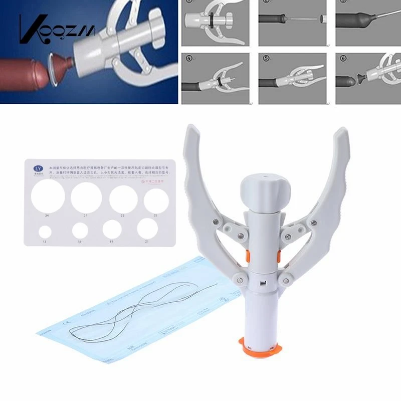 Disposable Foreskin Stapler Circumcision Stapler For Prepuce Genital