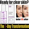 Shrinking Serum Lotion Deep Hydrating Moisturizing Firming Elastic Anti-Wrinkle Yeast Repair Lotion Korean Skin Care Products