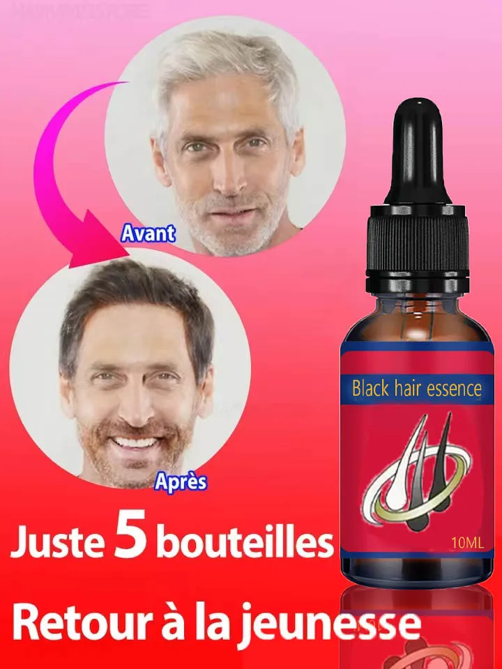 White hair killer remove gray hair and restore natural color in 7 days hair coloring product