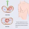 Child Pectus Excavatum Vacuum Bell -Kids Pectus Excavatum Orthosis Brace,Physical Correction,Washable,with Pressure Gauge 2