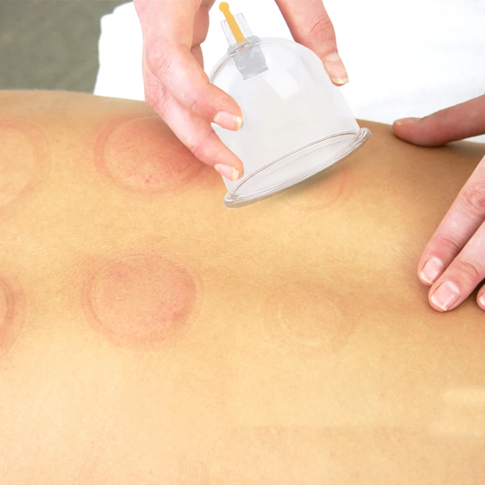 Ventouses De Massage Sous Vide En Verre - Pour Visage Et Cellulite - Neuf En Emballage - Acupuncture