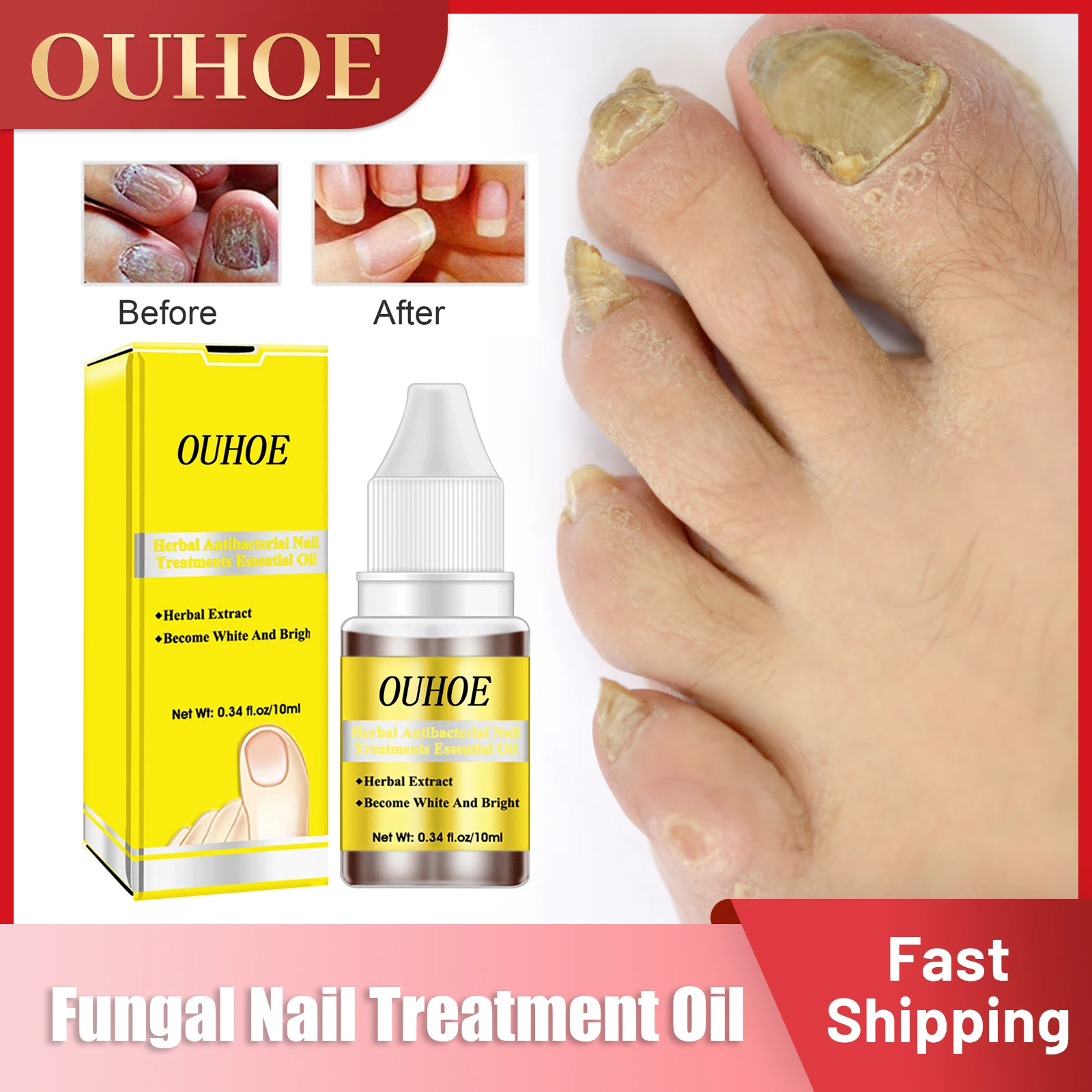 Fungal Nail Treatment Oil Foot Repair Essence Strong Nail Fungus