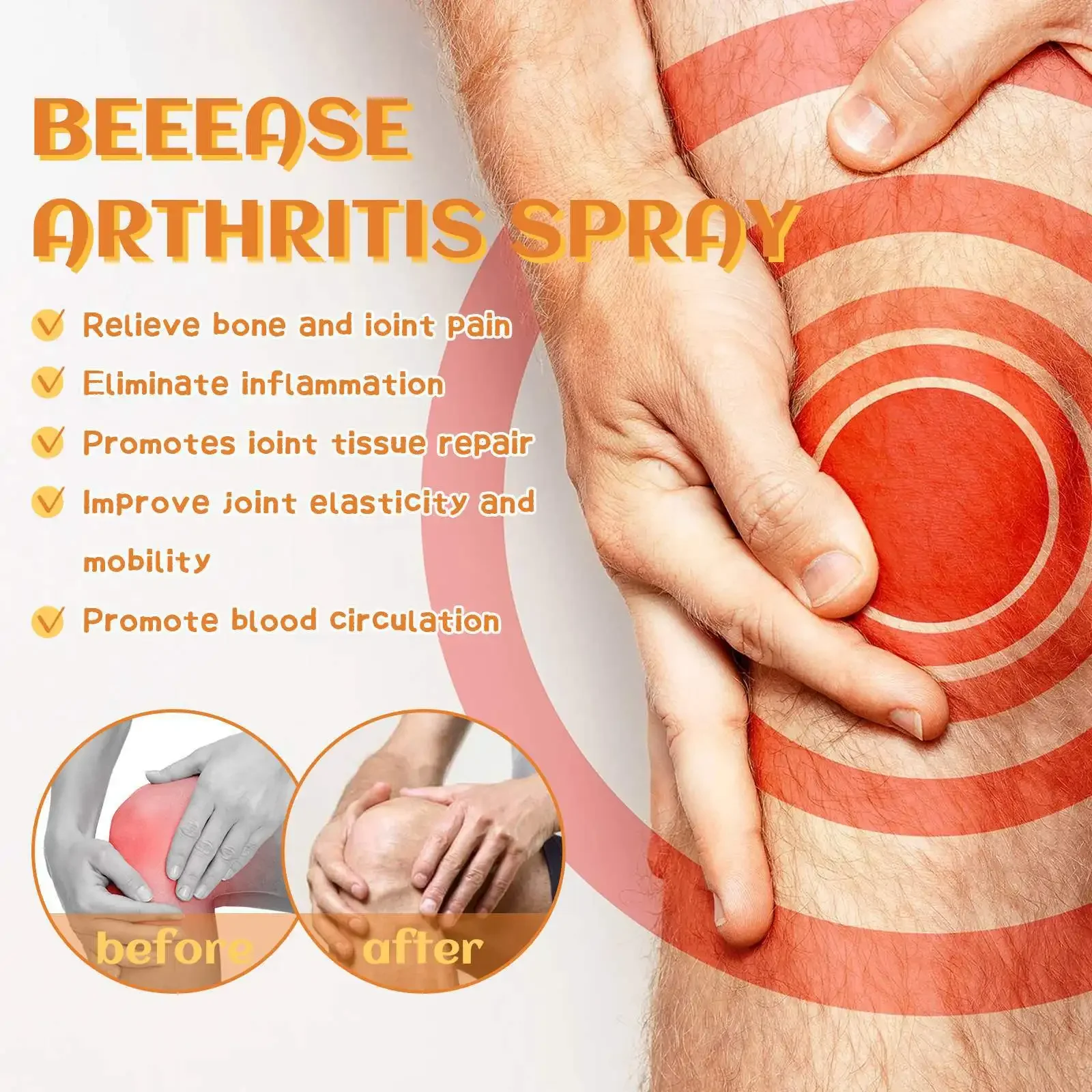 Pain Relief Cream Bee Venom Arthritis Spray Anti-Inflammatory Bone Therapy Muscle Ache Relief Treat Meniscus Sprain Medical Joint Analgesic Spray
