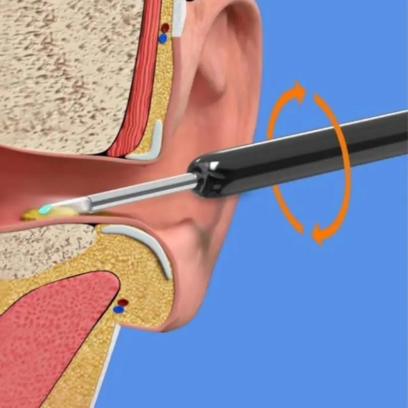 Earwax Removal Tool Wi-Fi Visible Wax Elimination Spoon 1080P USB HD Load Otoscope for Android IOS Phones