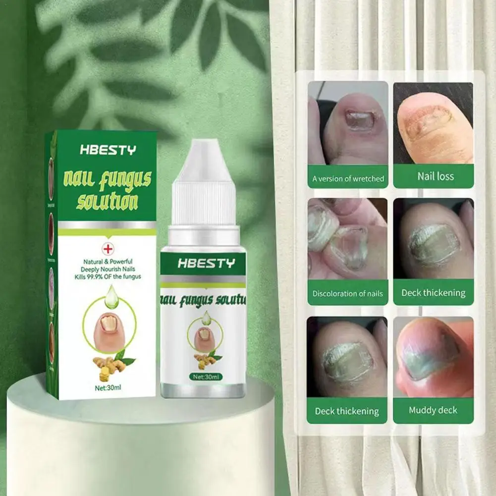 

Крем для лечения грибка ногтей, гель Footurel, уход за ногтями, восстановление, удаление онихомикоза, устранение неисправностей ногтей, питание, восстановление ногтей