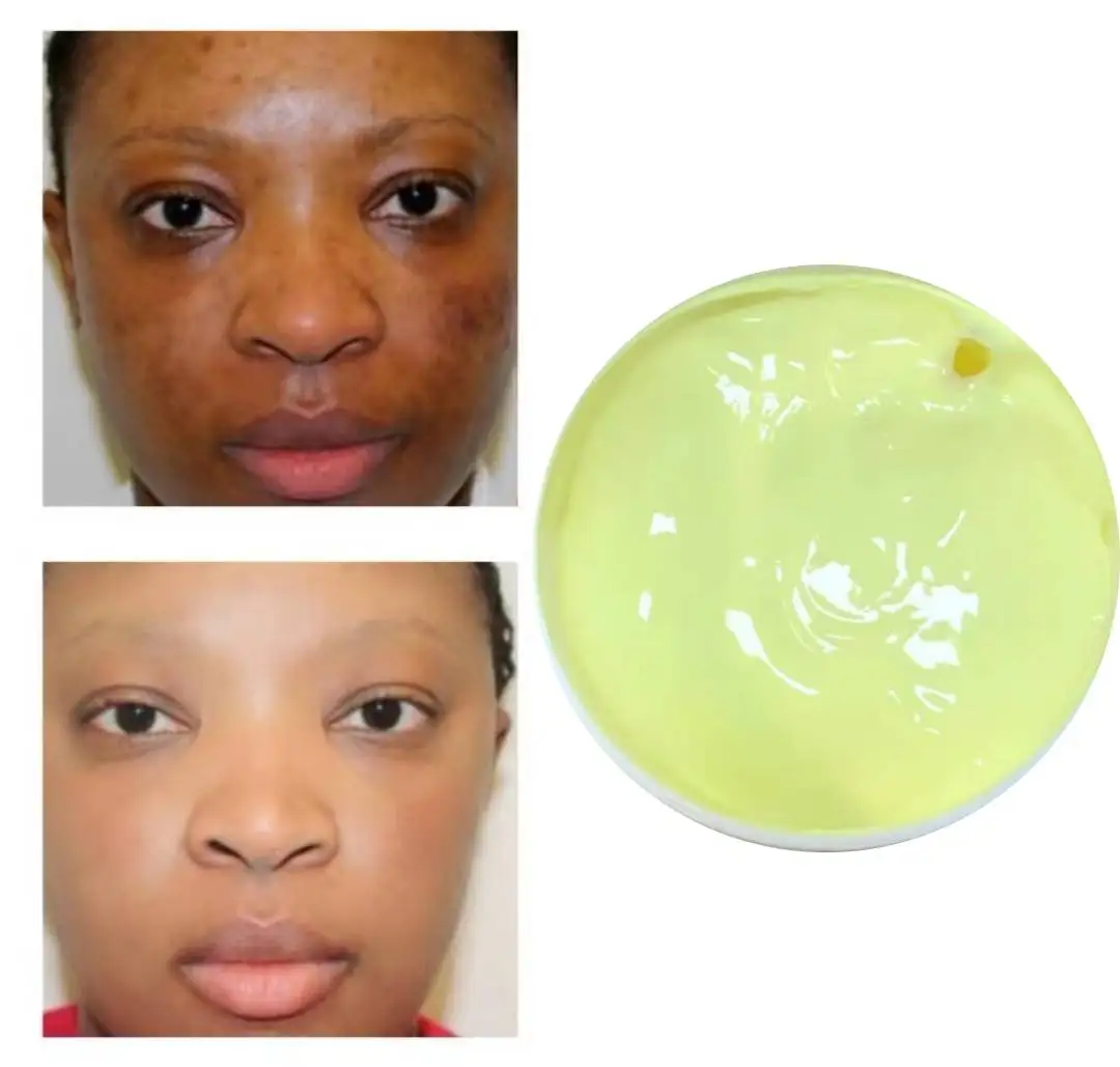 Strong lightening oil cream, Glowing cream, Moisturizing cream , 2 shades lighter 4