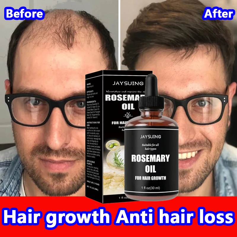 Rosemary Oil for Hair Growth Thick Eyebrow Eyelash Anti Hair Loss