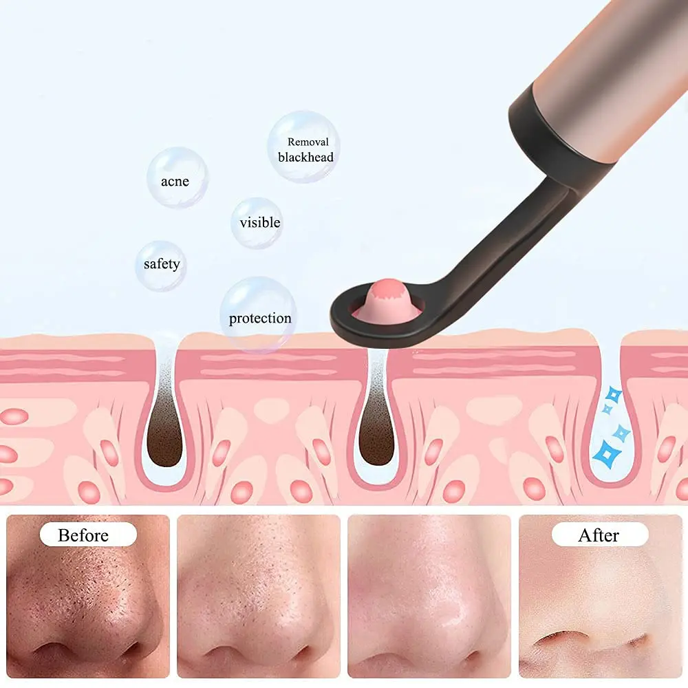 Bebird T15 Visual Eax Wax Picker Acne Blackhead Remover 2 in 1 Cleaning Tool With HD1080P Camera For APP Visible On ISO Andorid 5