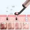 Bebird T15 Visual Eax Wax Picker Acne Blackhead Remover 2 in 1 Cleaning Tool With HD1080P Camera For APP Visible On ISO Andorid 5