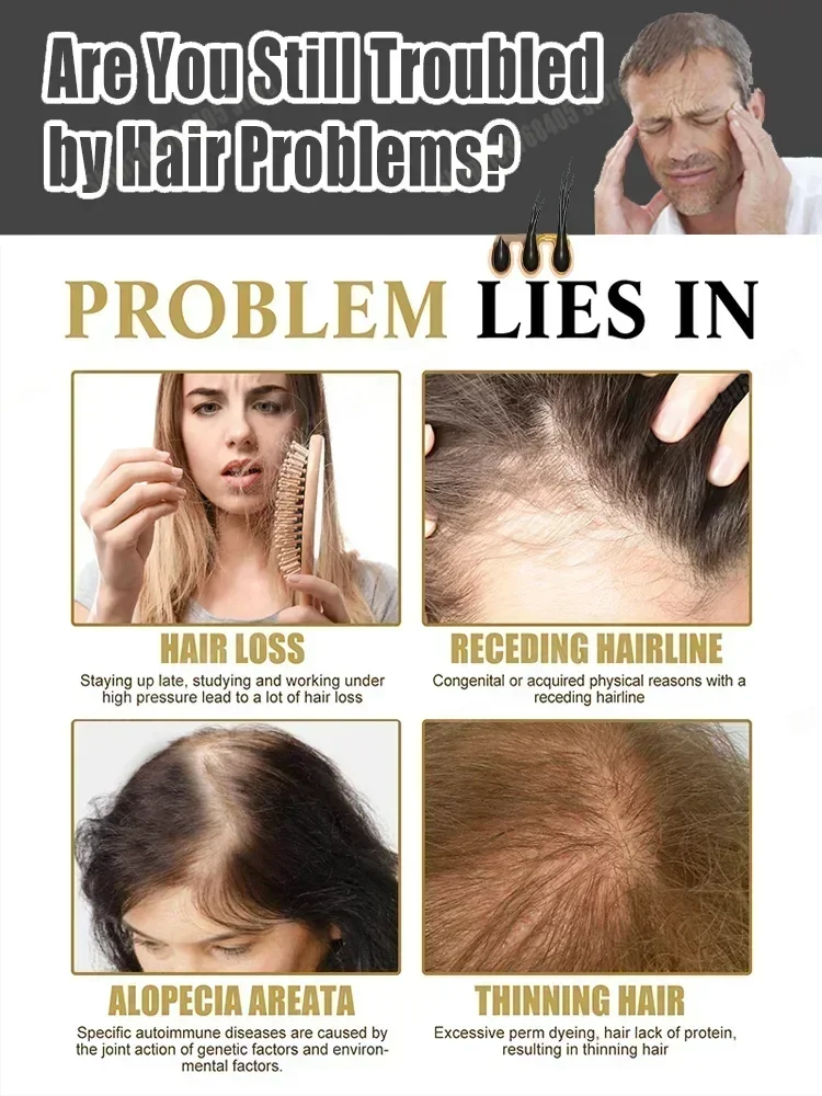 Fast Hair Growth Essence Effective Anti Hair Loss Serum Baldness Repair Hereditary Postpartum Seborrheic Loss oil Care
