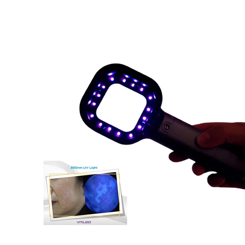 수의과 휴대용 개 고양이 나무 램프, 애완 동물 수의사, 365nm LED 손전등, 농장 동물용 소형 나무 램프 감지기