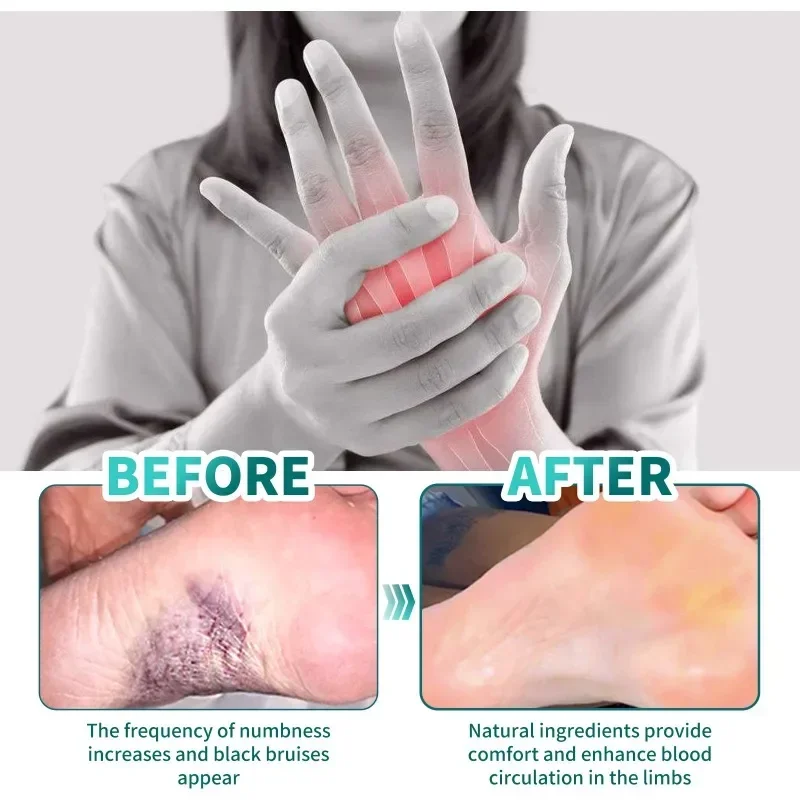 Hand Foot Numbness Health Cream Repair Joint Sore Swelling Relieve Cramp Muscle Strain Bone Ache Care Tratamiento De Relajaci&oacute;n pain analgesic cream