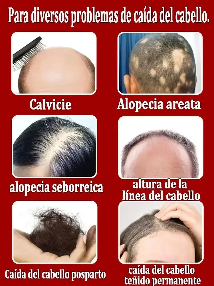 Effective Hair Growth Essential Oil Repairing Baldness and Hair