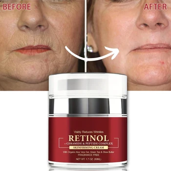 Instant retinol cream Removing wrinkles Firming Lifting Anti aging Dissolving Thin lines Moisturizing Whitening Korea Repair Skincare 1