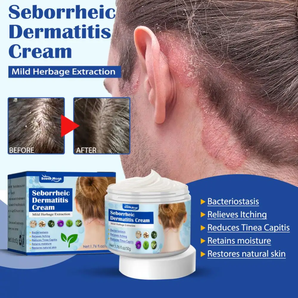 Scalp Treatment Hair Psoriasis Seborrheic Dermatitis Eczema Head Acne Pruritus Shampoo Repair Remove Dandruff