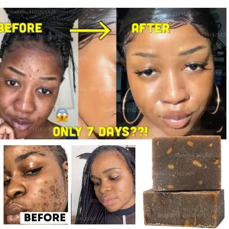 African Black Soap Remove Melanin Anti-aging Beauty Moisturizing Natural Bath Body Treatment