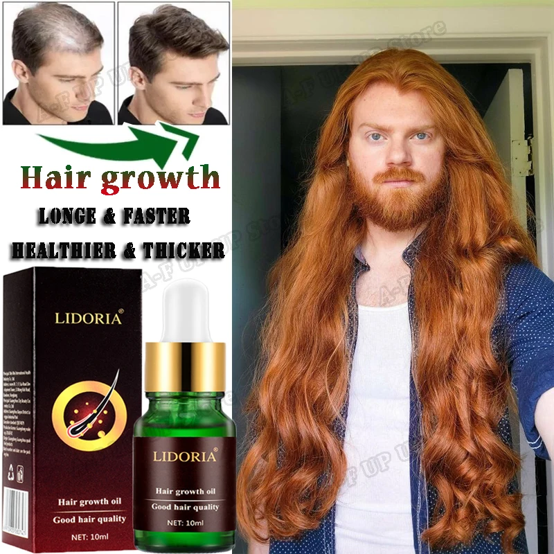 

Hair Growth Products Fast Hair Grow Serum Prevent Hair Loss Promote Hair Growth For Men Women Restore Thick Longer Hair Tonic