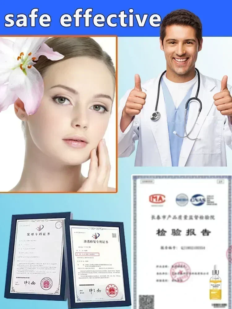 Facial Serum To Fine Lines Around The Eyes Crow's Feet Neck Wrinkl Serum Facial 5