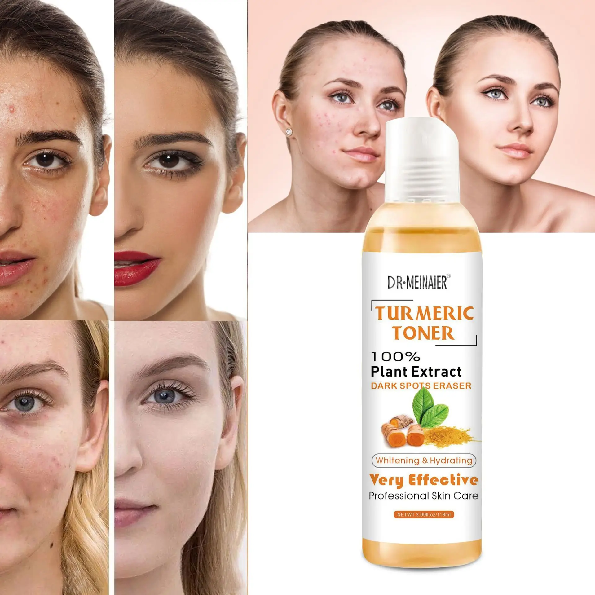 118ml Turmeric Moisturizing Toner Acne Remover Reduce Dullness & Black Spots Firming Skin Toner Essence for Skin Whitening