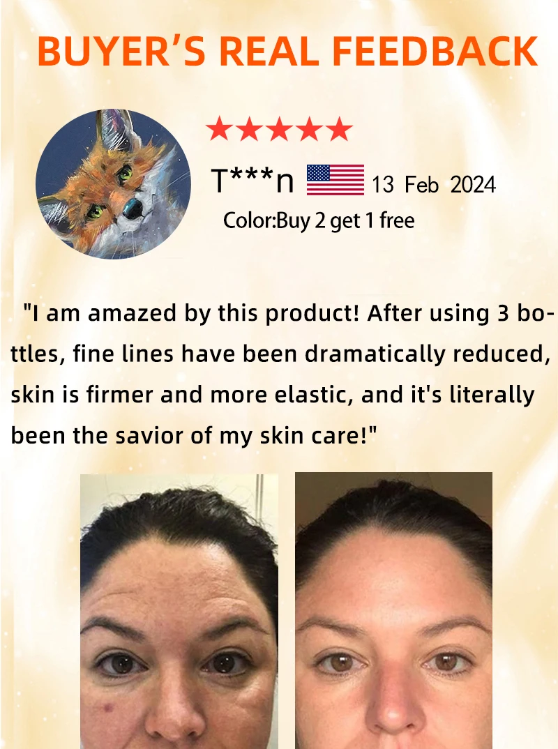 No Fine Lines ,For Wrinkles And Does Not Look Old_voghion.com