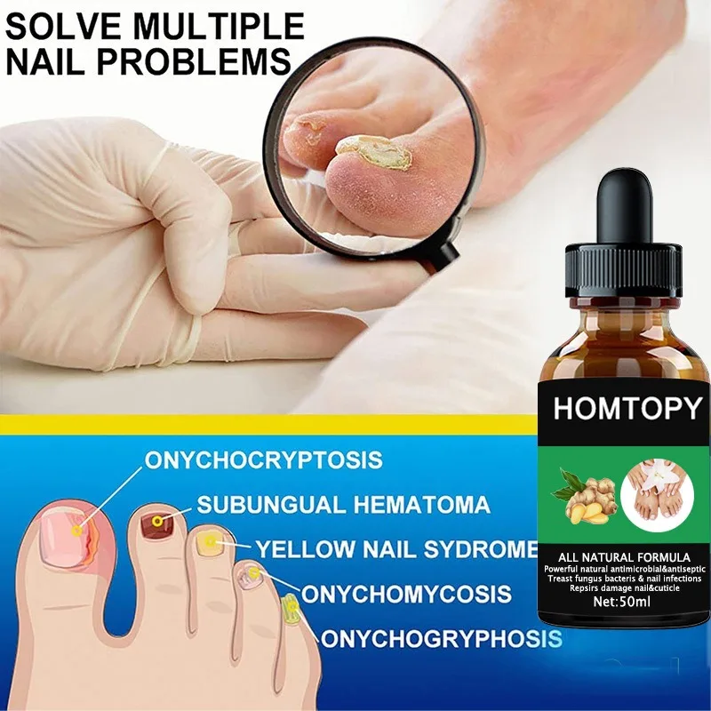 7 Days Nail Fungus Remover Serum Oil Foot Toe Nail Fungus Removal Repair Onychomycosi Anti Infection U&ntilde;as Care Products