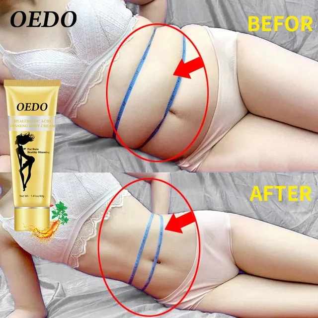 OEDO Hyaluronic Acid Ginseng Slimming Cream Reduce Cellulite Lose Weight Burning Fat Health Care Cream Body Skin Whitening Cream 3