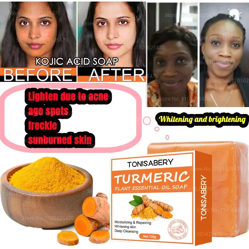 

Turmeric Cream Whitening Soap Natural Radiant Skin Smoothing Facial Reduction Acne Scars Dark Spots and Wrinkles Handmade Soap