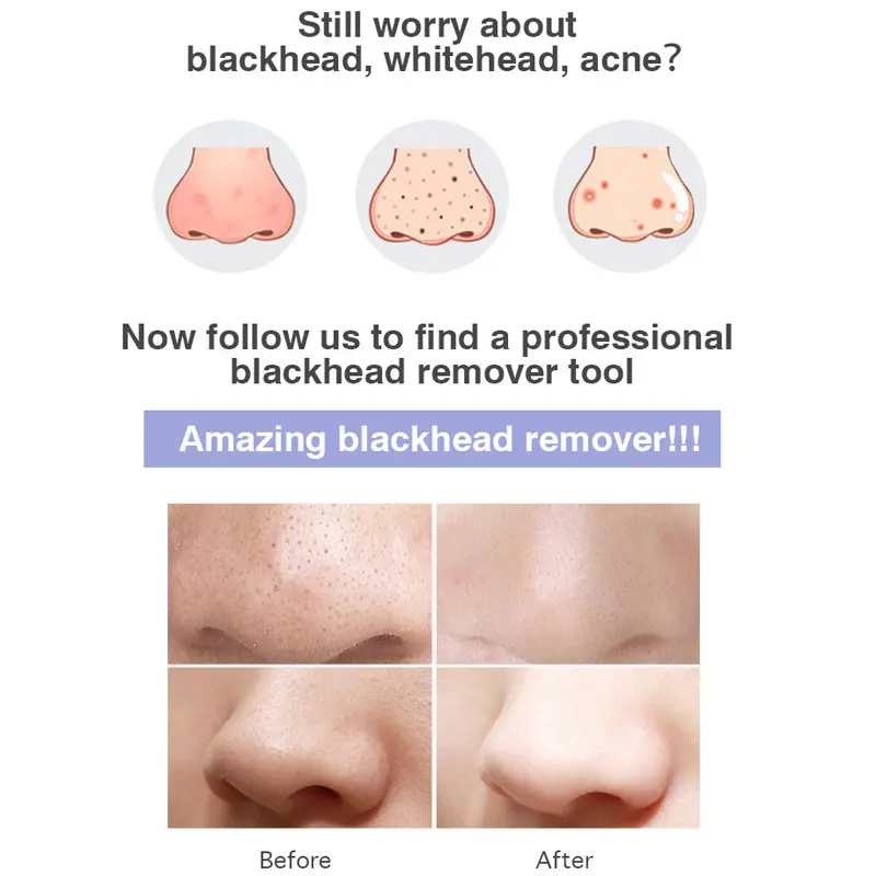 Face Cleansing Beauty Machine 3 Suction Mode Acne Blackheads Dead Skin Remover Electric Visual Cleaning