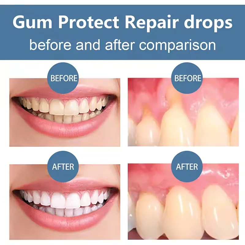 Gum Repair Drops Rapid Repair Gums Serum Effectively Relieve Tooth Allergy Dental Caries Tooth Cleaning Toothpaste Relieve Damage