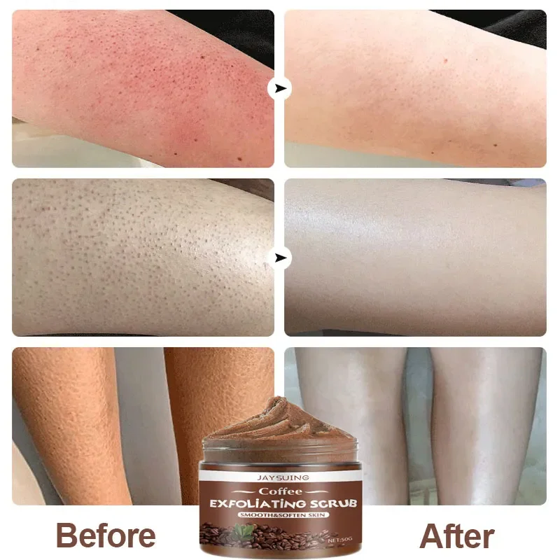 Coffee Body Scrub Cream Exfoliating Bleach Elbow Underarm Knee Melanin Pigmentation Whitening Remove Dead Skin Shower Scrub Care body scrub