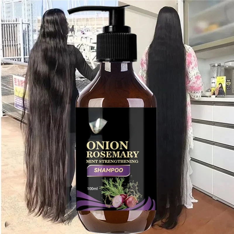Hair For Fast Hair Growth Rosemary Onion Regrowth Shampoo Anti Loss Effective Within 7 Day Growth Product
