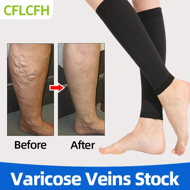 Varicose Veins Medical Socks Vasculitis Phlebittis Spider Legs Treatment  Vein Stretch Compression Stockings Black Flesh-Colored