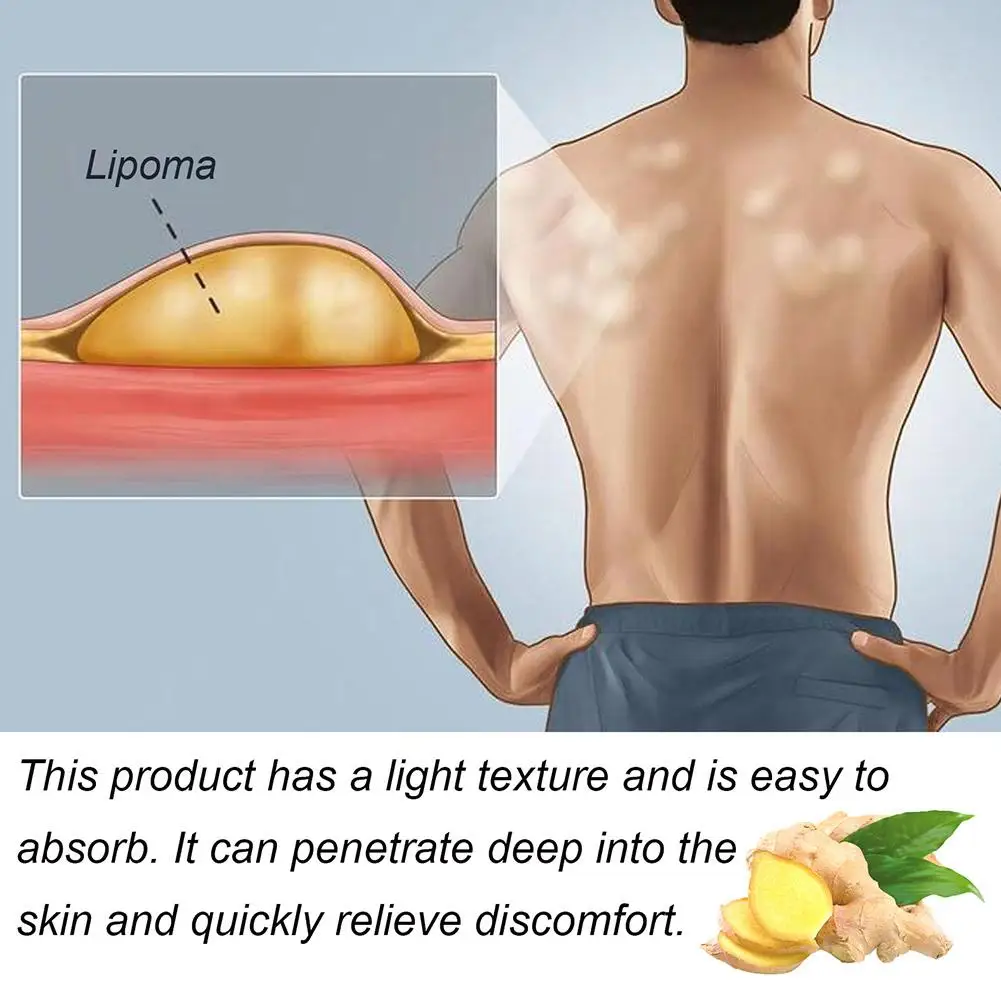 Lipoma Removal Herbal Cream 20g 1pc
