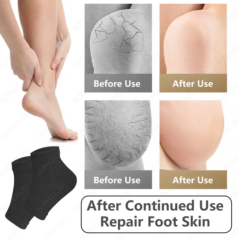 2PCS Gel Heel Socks for Moisturing Spa Gel Socks Feet Care Cracked Foot Dry Hard Skin Protector Prevent Dry Heel Feet Care Tools