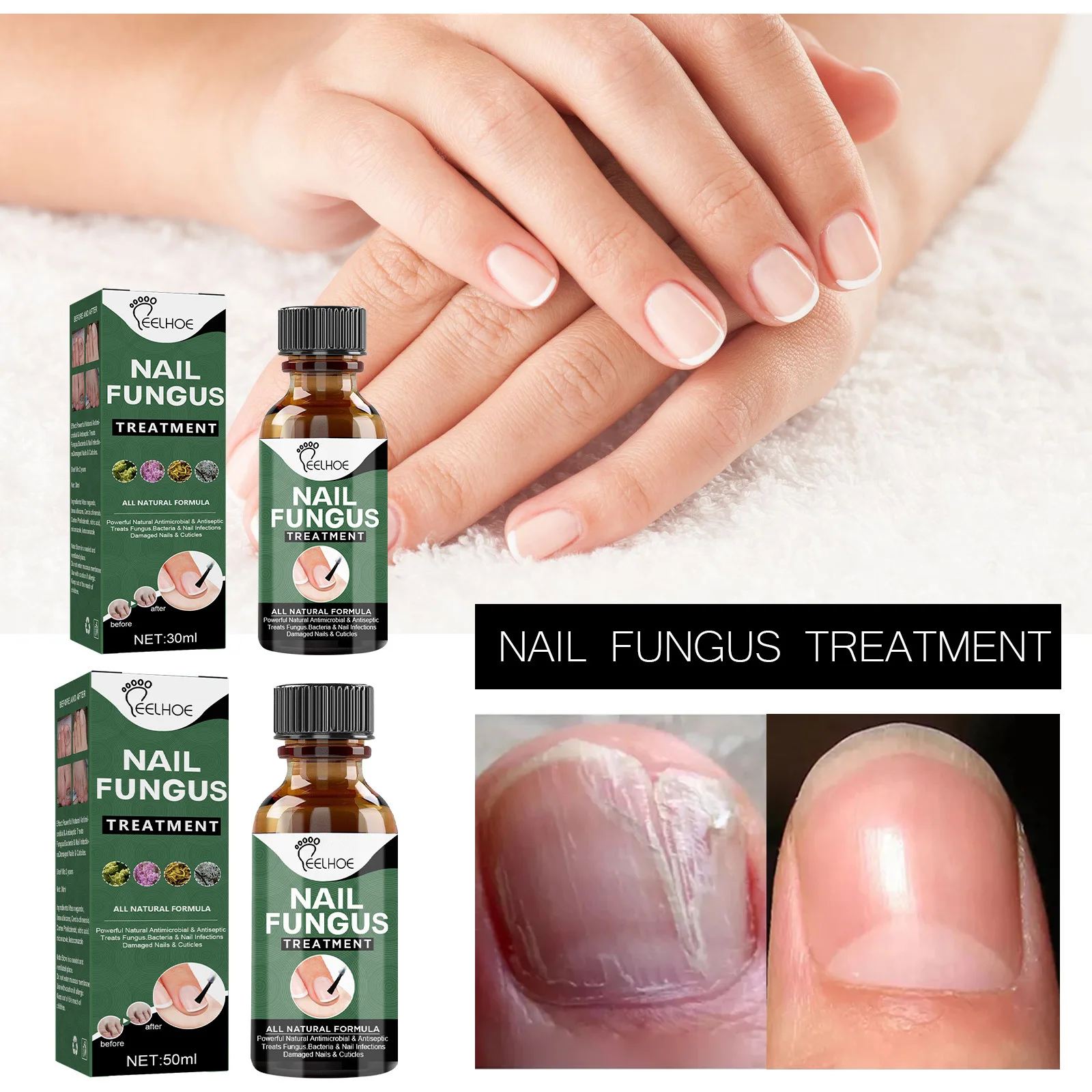 

Жидкость для ногтей, пилка для ухода за ногтями, противоударный грибок для ногтей, эссенция для онихомикоза, удаление грибковой кутикулы-гель для дизайна ногтей