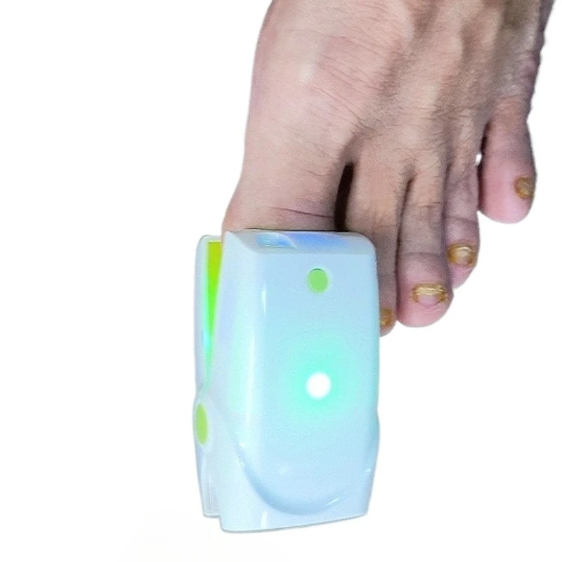 Laser Nail Fungus Remover - Professional Onychomycosis Treatment Device for Healthy Nails