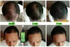 120ml Ne Hair Lotion Hair Root HAIR BEARD SIDEBURNS LONGER Herbs Treatment 100% Original Thailand Free Gift