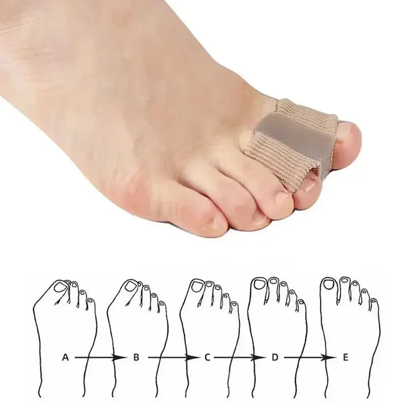 Description Picture 6 of item1PCS Toe Separator Hallux Valgus Bunion Corrector Orthotics Night Foot Care Thumb Daily Big Bone Tool Pedicure Feet Straightener