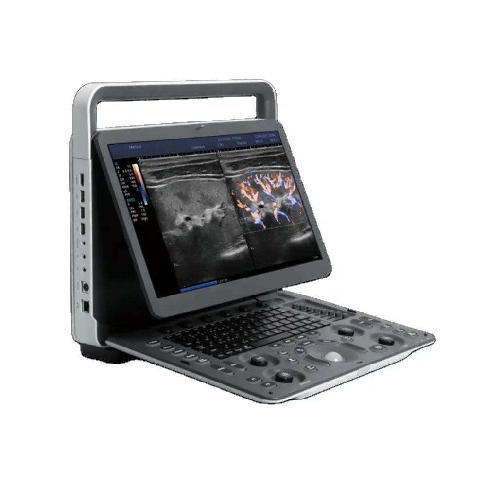 Sonoscape E2 Ultrasuoni Portatili Auto Imt Color Doppler Macchina Ad Ultrasuoni Ecografo Sonoscape