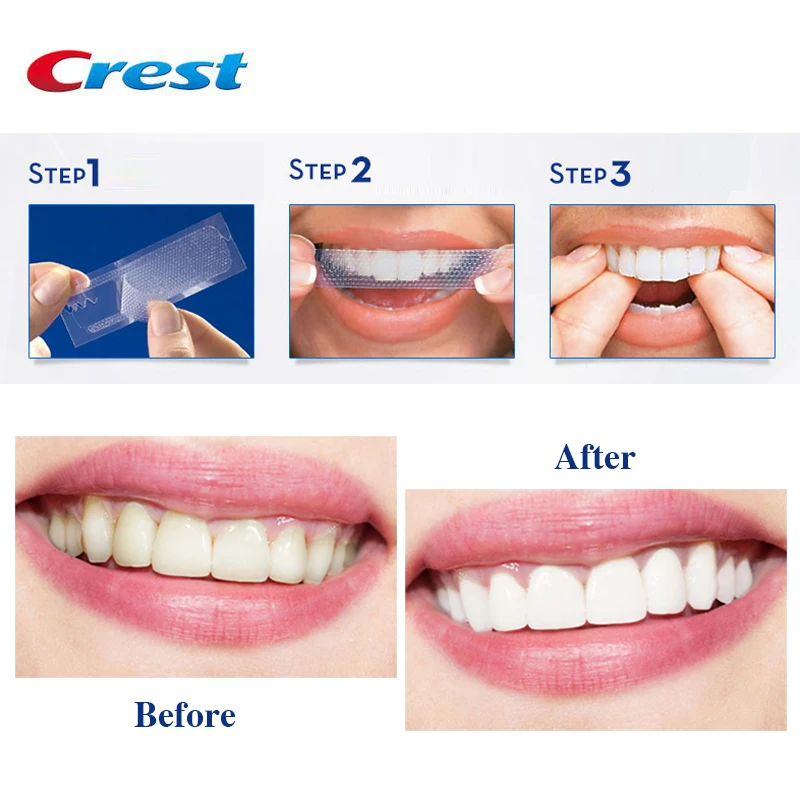 Teeth Whitening Strips Crest 3D Glamorous Whitestrips Professional Effects 30 Minutes White Teeth no Pain Oral Hygiene Care