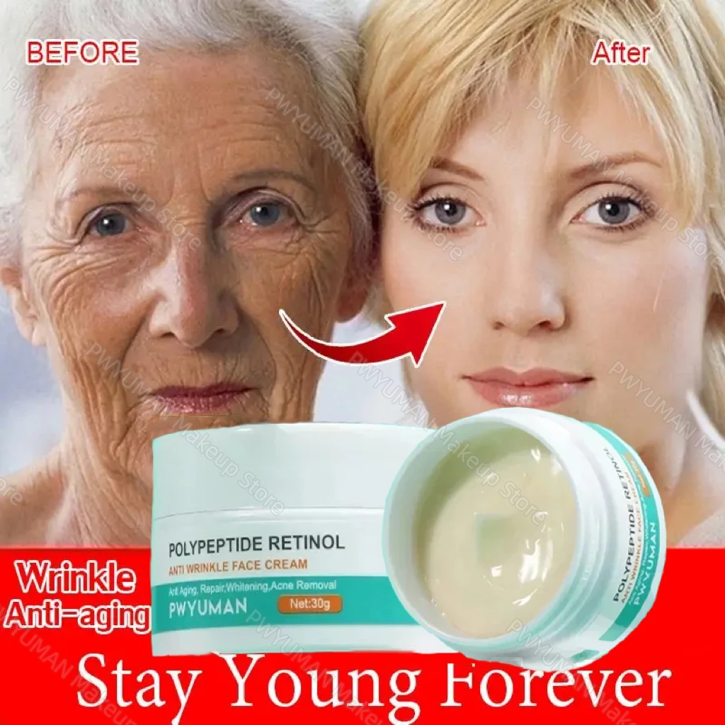 

Retinol Wrinkle Remover Face Cream Anti-Aging Lifting Firming Fade Fine Lines Acne Treatment Whitening Moisturizing Skin Care